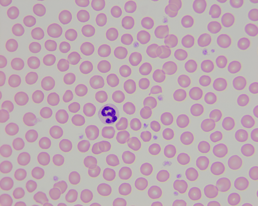 Catching Up To Human Treatments For Canine AML Cornell University   Normal Dog Blood 100x1 